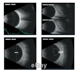 Scanner Ophthalmic A / B L'échographie De L'écran LCD 15 Pouces Eye 10 Mhz Fréquence